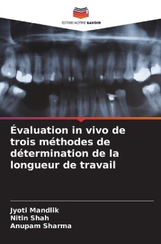 Cover of �valuation in vivo de trois m�thodes de d�termination de la longueur de travail