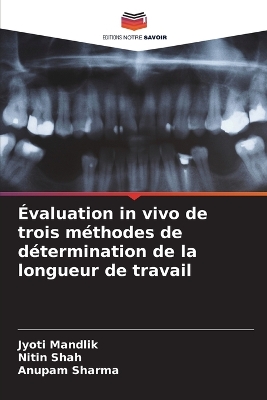 Book cover for �valuation in vivo de trois m�thodes de d�termination de la longueur de travail