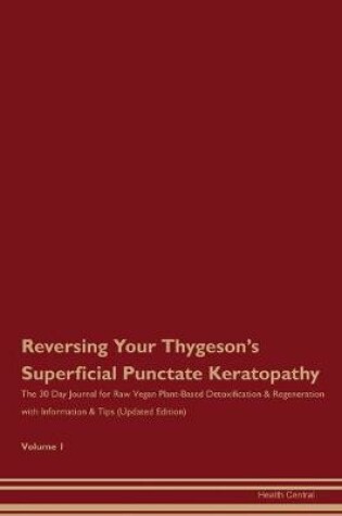 Cover of Reversing Your Thygeson's Superficial Punctate Keratopathy