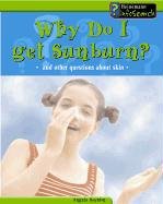 Book cover for Why Do I Get a Sunburn?