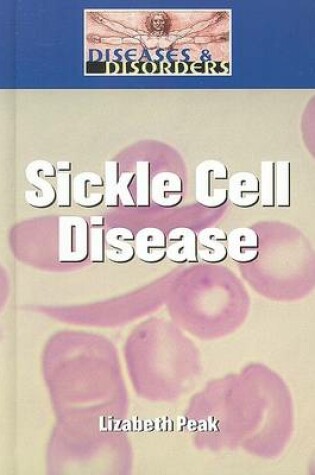 Cover of Sickle Cell Disease