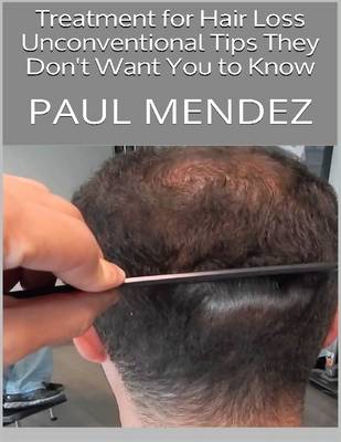 Book cover for Treatment for Hair Loss: Unconventional Tips They Don't Want You to Know