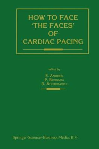 Cover of How to Face 'The Faces' of Cardiac Pacing