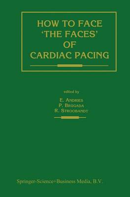 Book cover for How to Face 'The Faces' of Cardiac Pacing