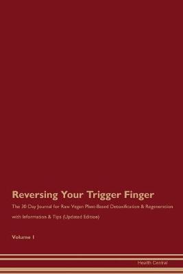 Book cover for Reversing Your Trigger Finger