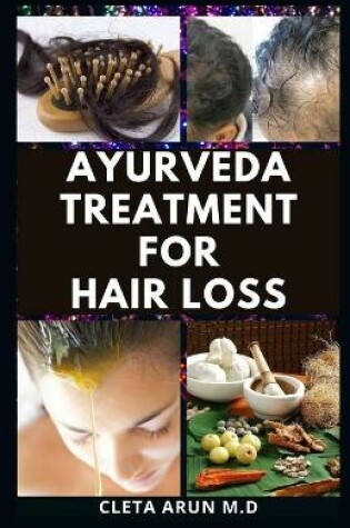 Cover of Ayurveda Treatment for Hair Loss