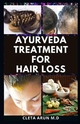 Book cover for Ayurveda Treatment for Hair Loss