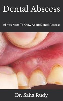 Book cover for Dental Abscess