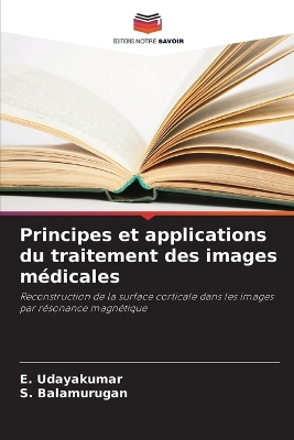 Book cover for Principes et applications du traitement des images médicales