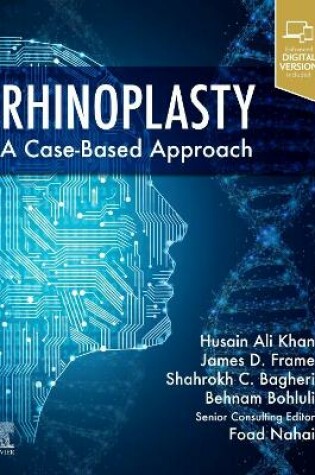 Cover of Rhinoplasty