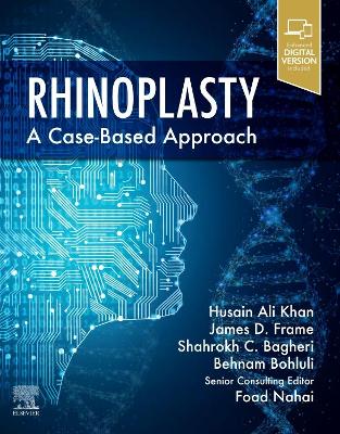 Book cover for Rhinoplasty