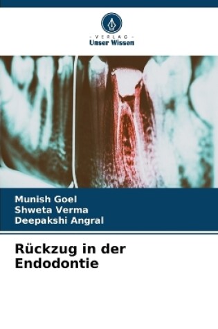 Cover of Rückzug in der Endodontie