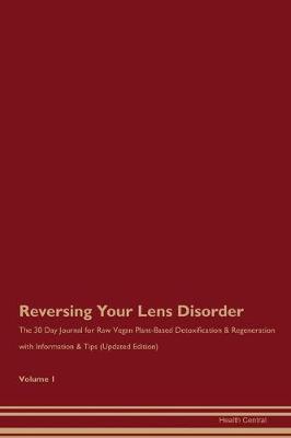 Book cover for Reversing Your Lens Disorder