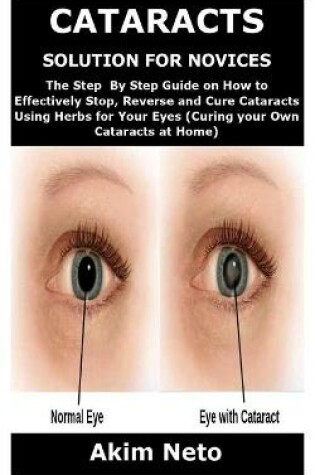 Cover of Cataracts Solution for Novices