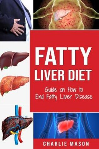 Cover of Fatty Liver Diet: Guide on How to End Fatty Liver Disease: Fatty Liver Diet Books