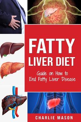 Book cover for Fatty Liver Diet: Guide on How to End Fatty Liver Disease: Fatty Liver Diet Books