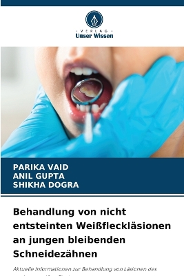 Book cover for Behandlung von nicht entsteinten Weißfleckläsionen an jungen bleibenden Schneidezähnen
