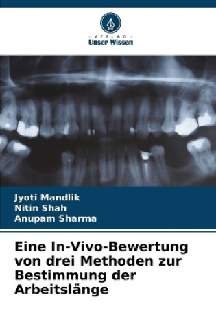 Cover of Eine In-Vivo-Bewertung von drei Methoden zur Bestimmung der Arbeitsl�nge