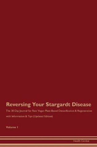 Cover of Reversing Your Stargardt Disease