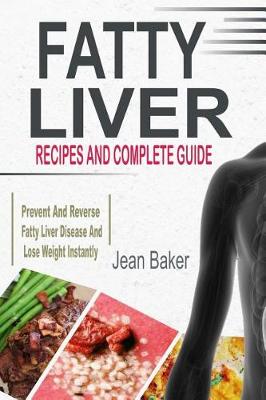 Book cover for Fatty Liver