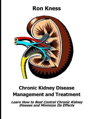 Book cover for Chronic Kidney Disease Management and Treatment