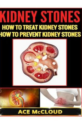 Cover of Kidney Stones