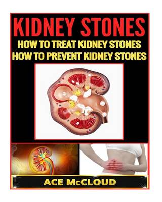 Book cover for Kidney Stones