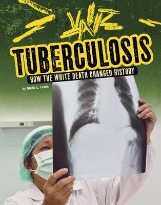 Book cover for Tuberculosis