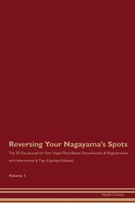 Book cover for Reversing Your Nagayama's Spots