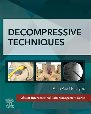 Book cover for Decompressive Techniques