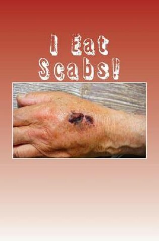 Cover of I Eat Scabs!