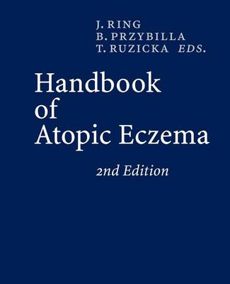 Cover of Handbook of Atopic Eczema