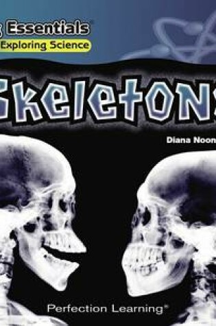 Cover of Skeletons