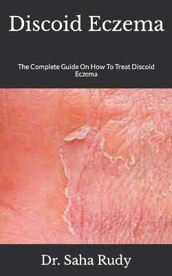 Book cover for Discoid Eczema