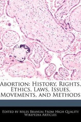 Cover of Abortion