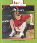 Book cover for Bruises