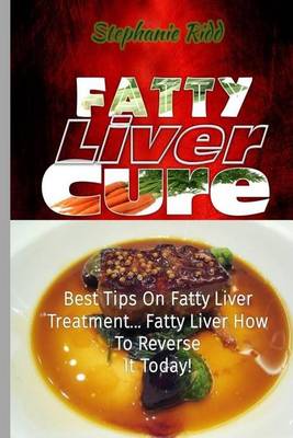 Book cover for Fatty Liver Cure