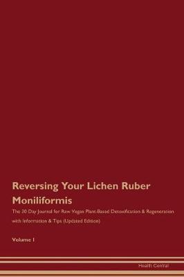 Book cover for Reversing Your Lichen Ruber Moniliformis