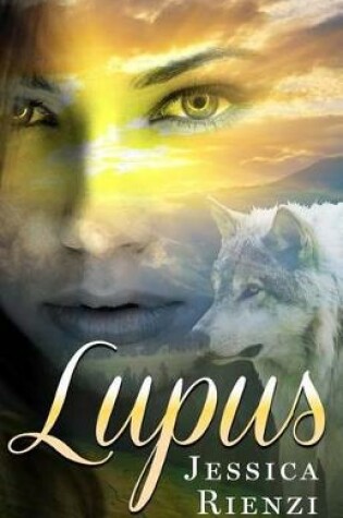 Cover of Lupus