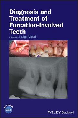 Book cover for Diagnosis and Treatment of Furcation-Involved Teeth
