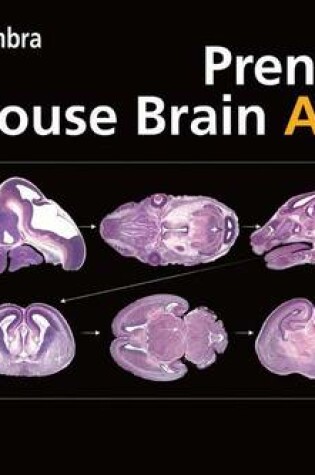 Cover of Prenatal Mouse Brain Atlas: Color Images and Annotated Diagrams Of: Gestational Days 12, 14, 16 and 18 Sagittal, Coronal and Horizontal Section