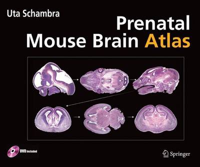 Book cover for Prenatal Mouse Brain Atlas: Color Images and Annotated Diagrams Of: Gestational Days 12, 14, 16 and 18 Sagittal, Coronal and Horizontal Section