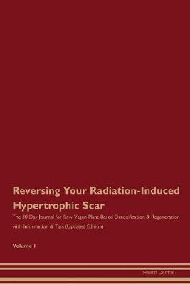 Book cover for Reversing Your Radiation-Induced Hypertrophic Scar