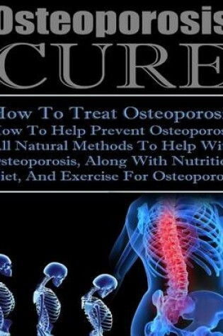 Cover of Osteoporosis Cure How to Treat Osteoporosis, How to Help Prevent Osteoporosis, All Natural Methods to Help with Osteoporosis, Along with Nutrition Diet and Exercise for Osteoporosis
