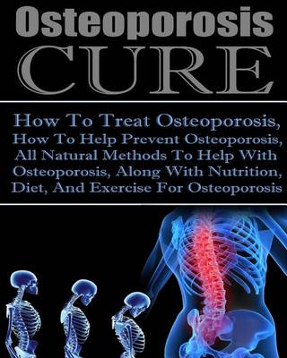 Book cover for Osteoporosis Cure How to Treat Osteoporosis, How to Help Prevent Osteoporosis, All Natural Methods to Help with Osteoporosis, Along with Nutrition Diet and Exercise for Osteoporosis