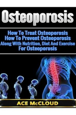 Cover of Osteoporosis