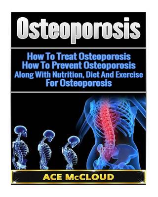 Book cover for Osteoporosis