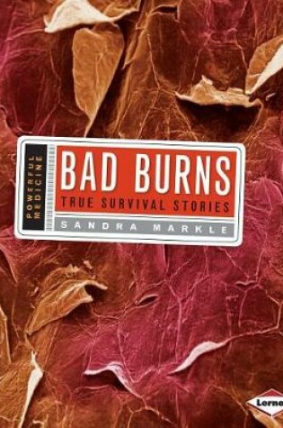 Cover of Bad Burns