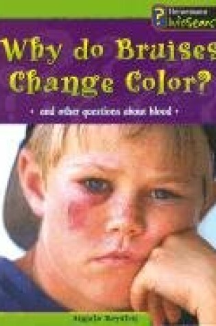 Cover of Why Do Bruises Change Color?