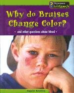 Cover of Why Do Bruises Change Color?